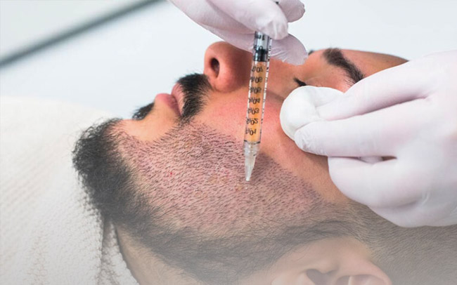 Inhairclinics: Natuurlijke Resultaten bij het Expertisecentrum voor Haar-, Wenkbrauw- en Baardtransplantatie