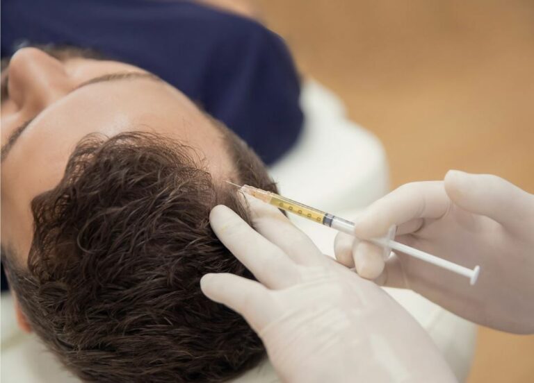 PRP of Mesotherapie? Welke Behandeling Is Effectiever bij Haaruitval?